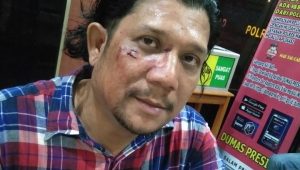 SMSI Pusat Desak Polisi Usut Kasus Penganiayaan Ketua SMSI Madina